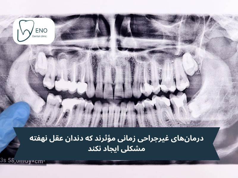 روشهای درمان بدون جراحی