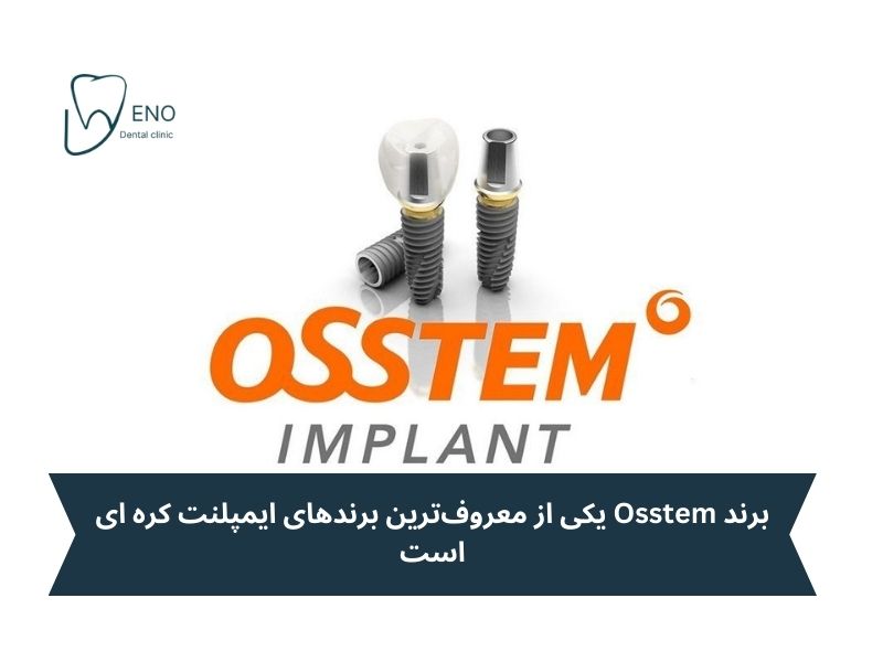 ایمپلنت کره ای اوستم