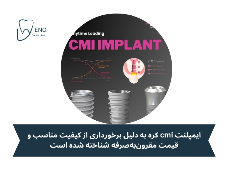 ایمپلنت CIM کره