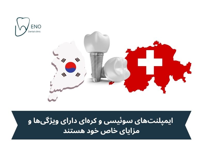 ایمپلنت سوئیسی یا کره ای