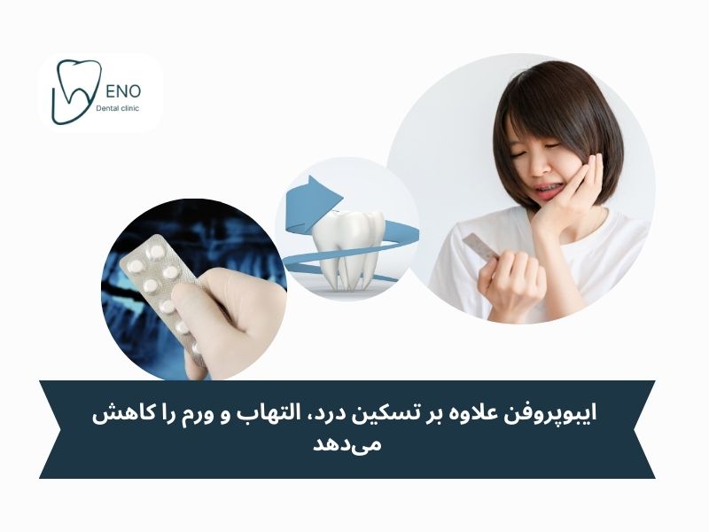 بهترین مسکنها برای درد دندان عقل