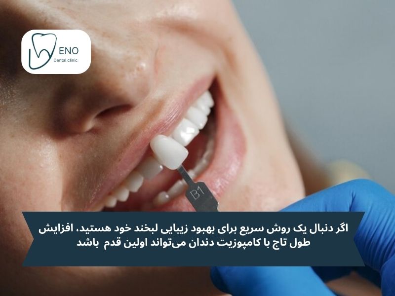 افزایش طول تاج دندان با کامپوزیت