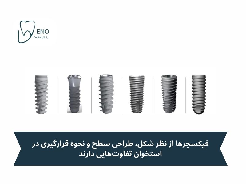 انواع پیچ ایمپلنت را بشناسیم