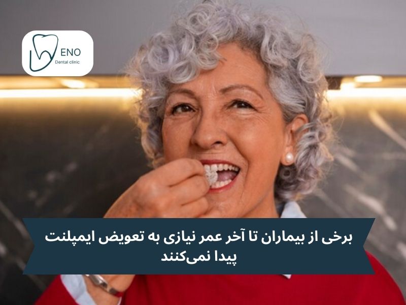 عوامل مؤثر بر طول عمر ایمپلنت دندانی