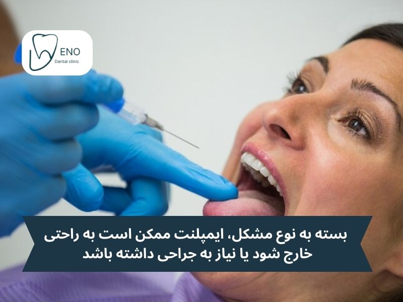 مراحل تعویض ایمپلنت دندانی چگونه است