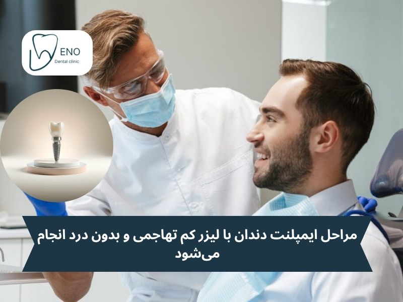 مراحل ایمپلنت دندان با لیزر