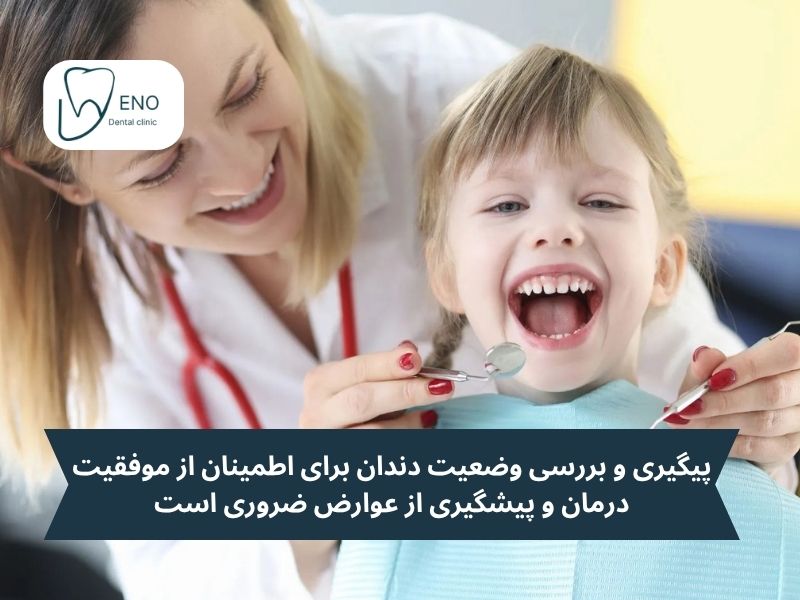 مراقبتهای ضروری بعد از پالپوتومی