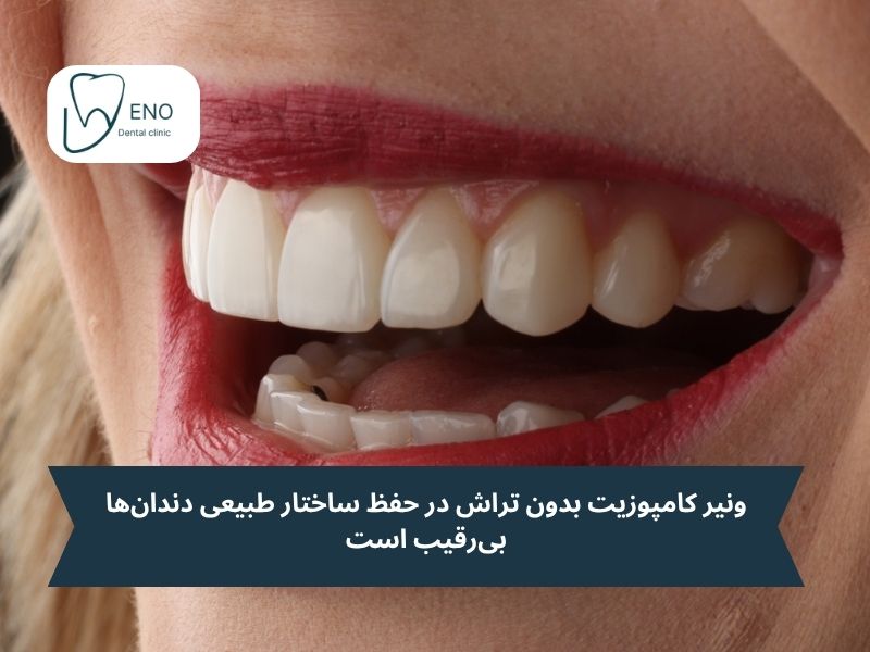 مزایای ونیر کامپوزیت بدون تراش
