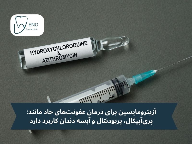 آزیترومایسین برای درمان عفونتهای حاد مانند: پریآپیکال، پریودنتال و آبسه دندان کاربرد دارد