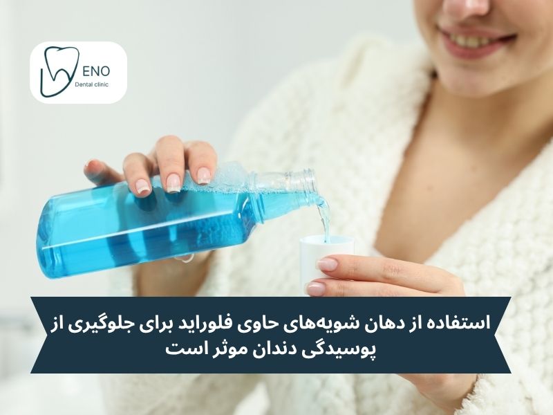 استفاده از دهان شویههای حاوی فلوراید برای جلوگیری از پوسیدگی دندان موثر است