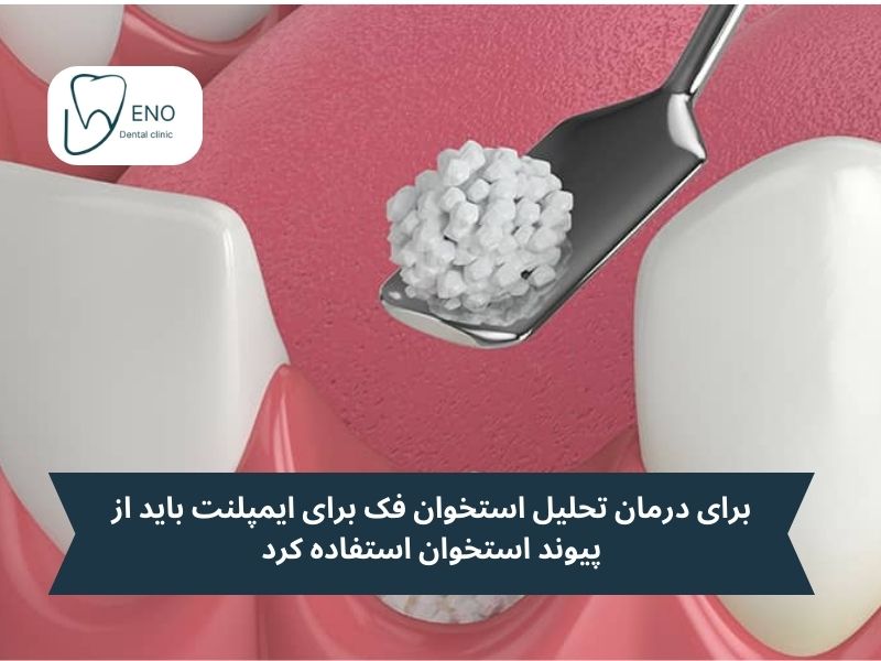 عواقب تحلیل استخوان فک