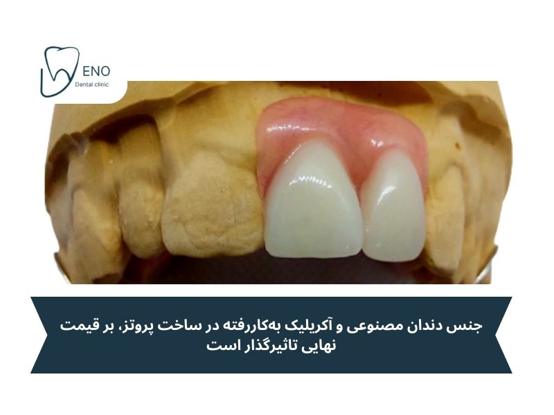 قیمت فلیپر دندان در سال