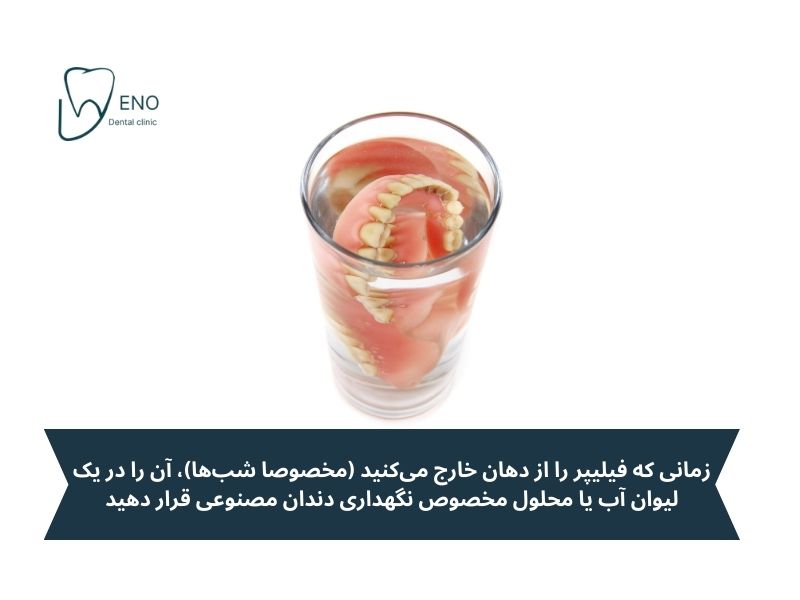 مراقبت و نگهداری از فیلیپر