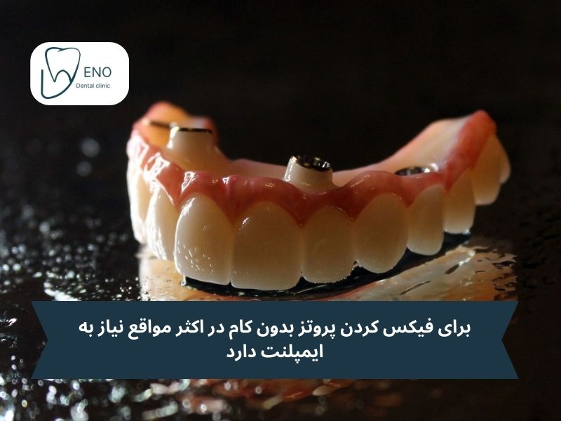 معایب پروتز بدون کام
