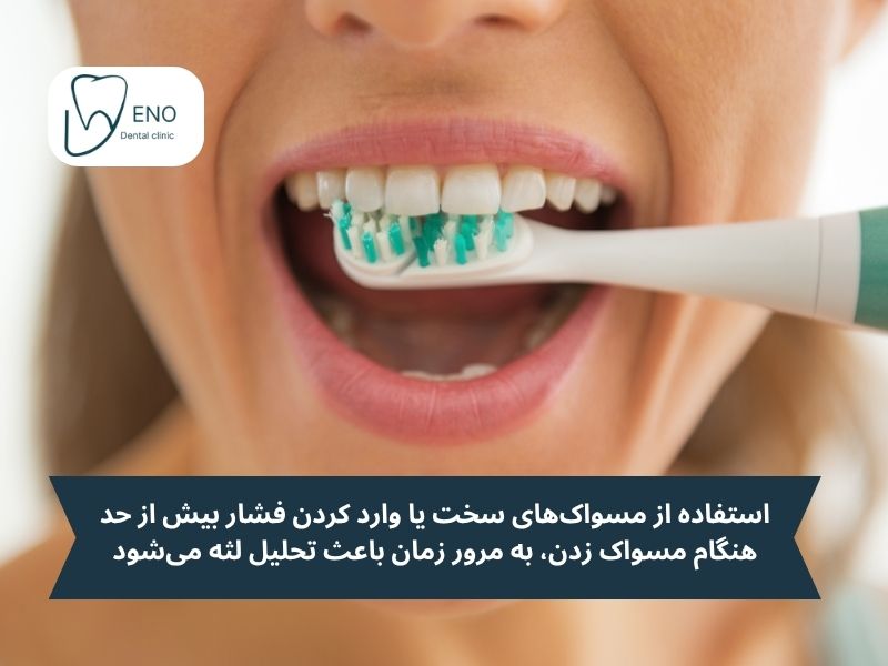 چرا لثههای من تحلیل میرود