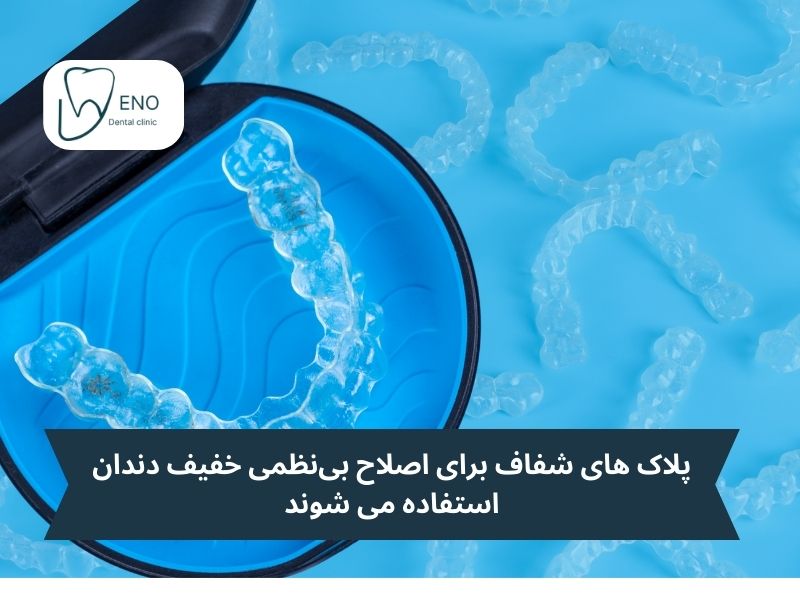 انواع ارتودنسی متحرک