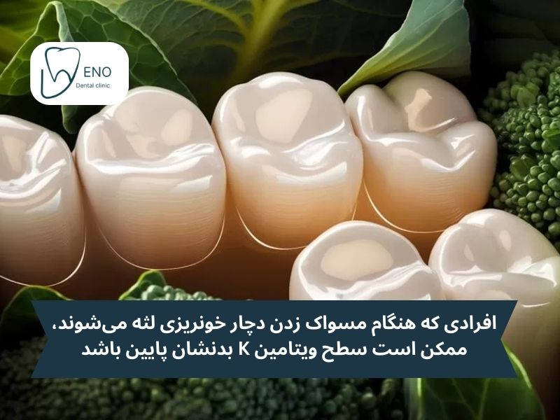 نقش ویتامین K در خونریزی لثه