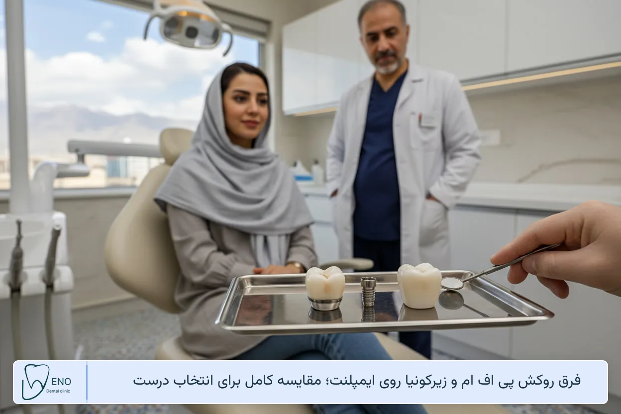 فرق روکش پی اف ام و زیرکونیا روی ایمپلنت