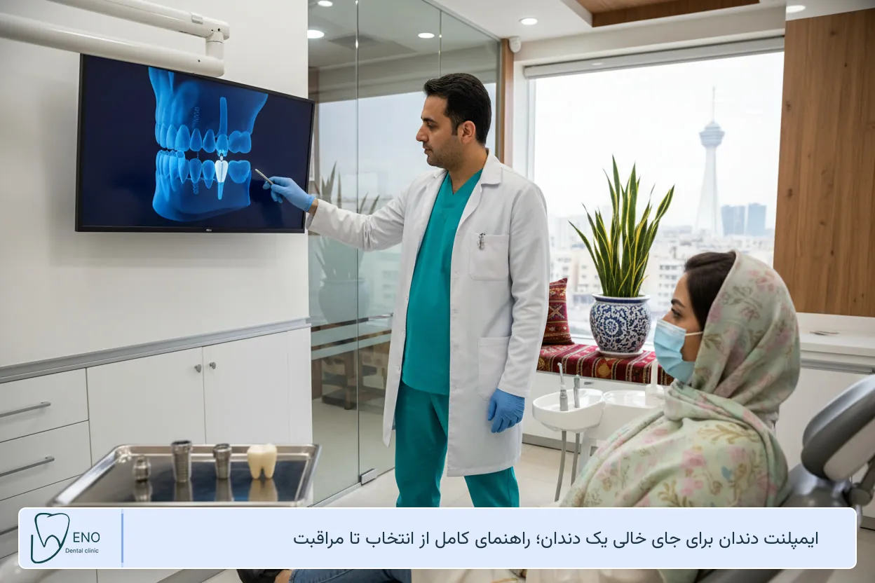 ایمپلنت دندان برای جای خالی یک دندان