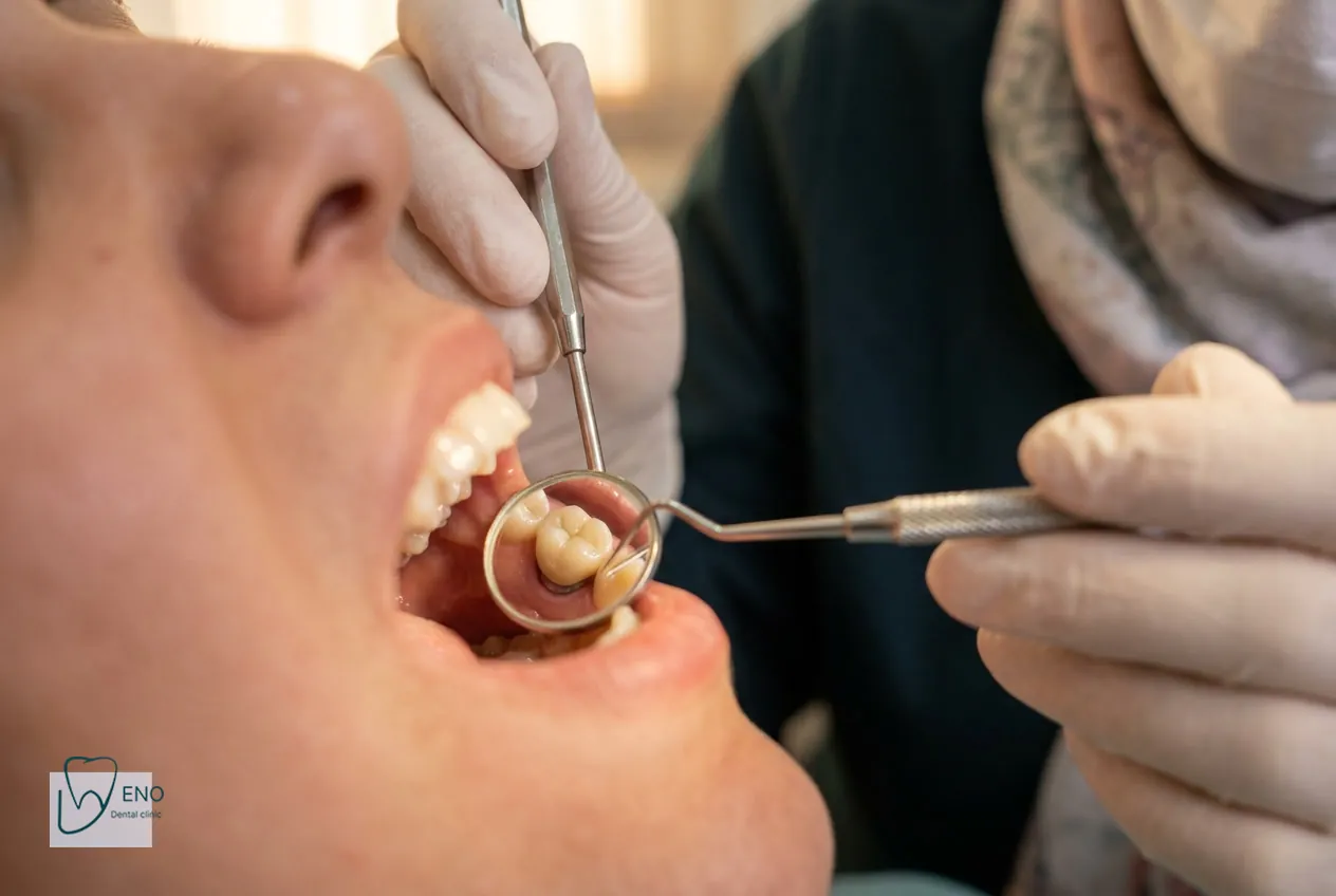 راهنمای عملی برای افزایش طول عمر ایمپلنت کرهای