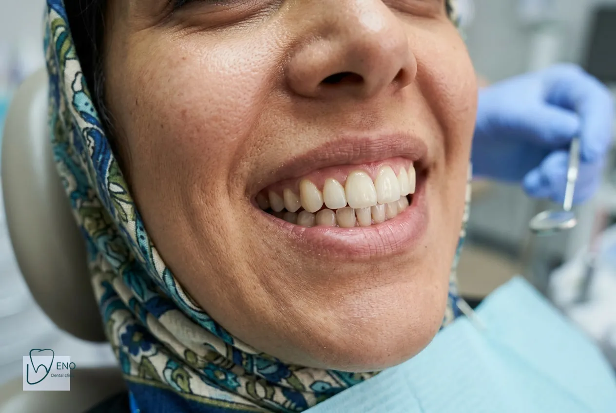 نکات کلیدی درباره روکش ایمپلنت و تاثیر آن بر رضایت